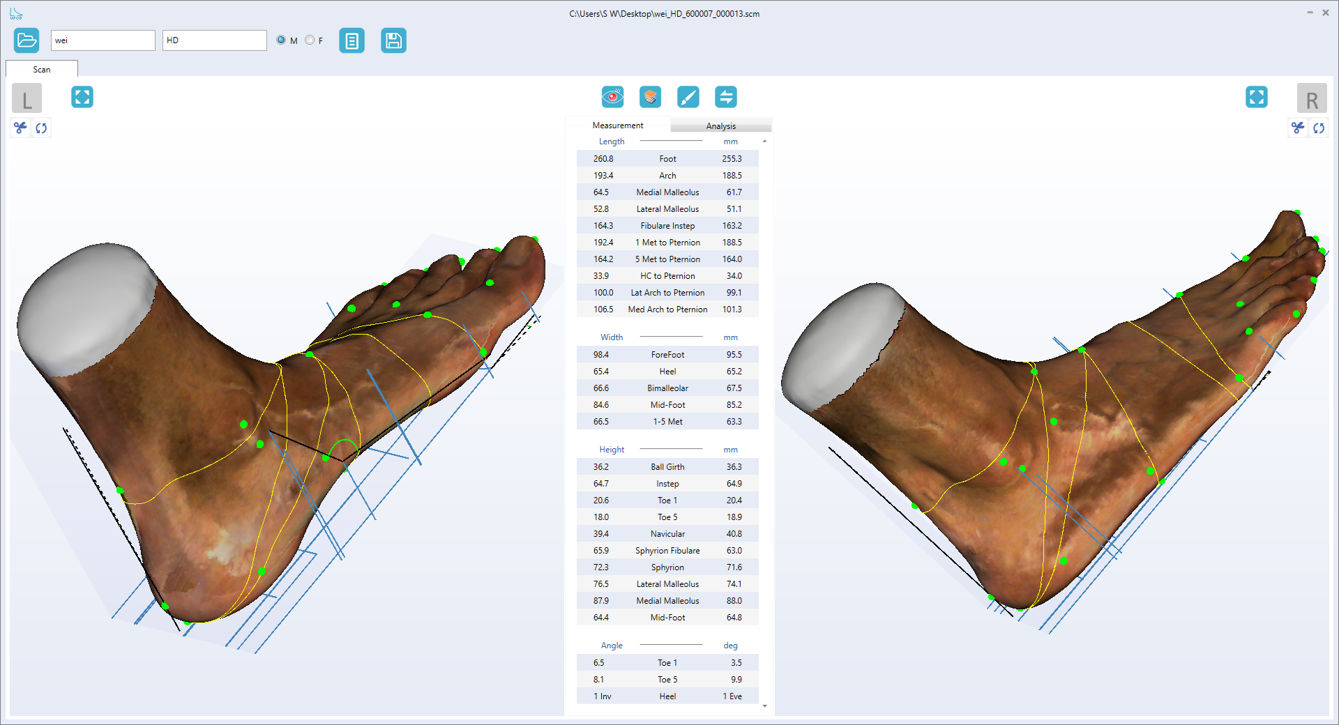 Precision Dynamic Foot Printer 维码科技 | Vismach 3D Laser Foot Scanner | Orthotic Insole CAD & CAM ...