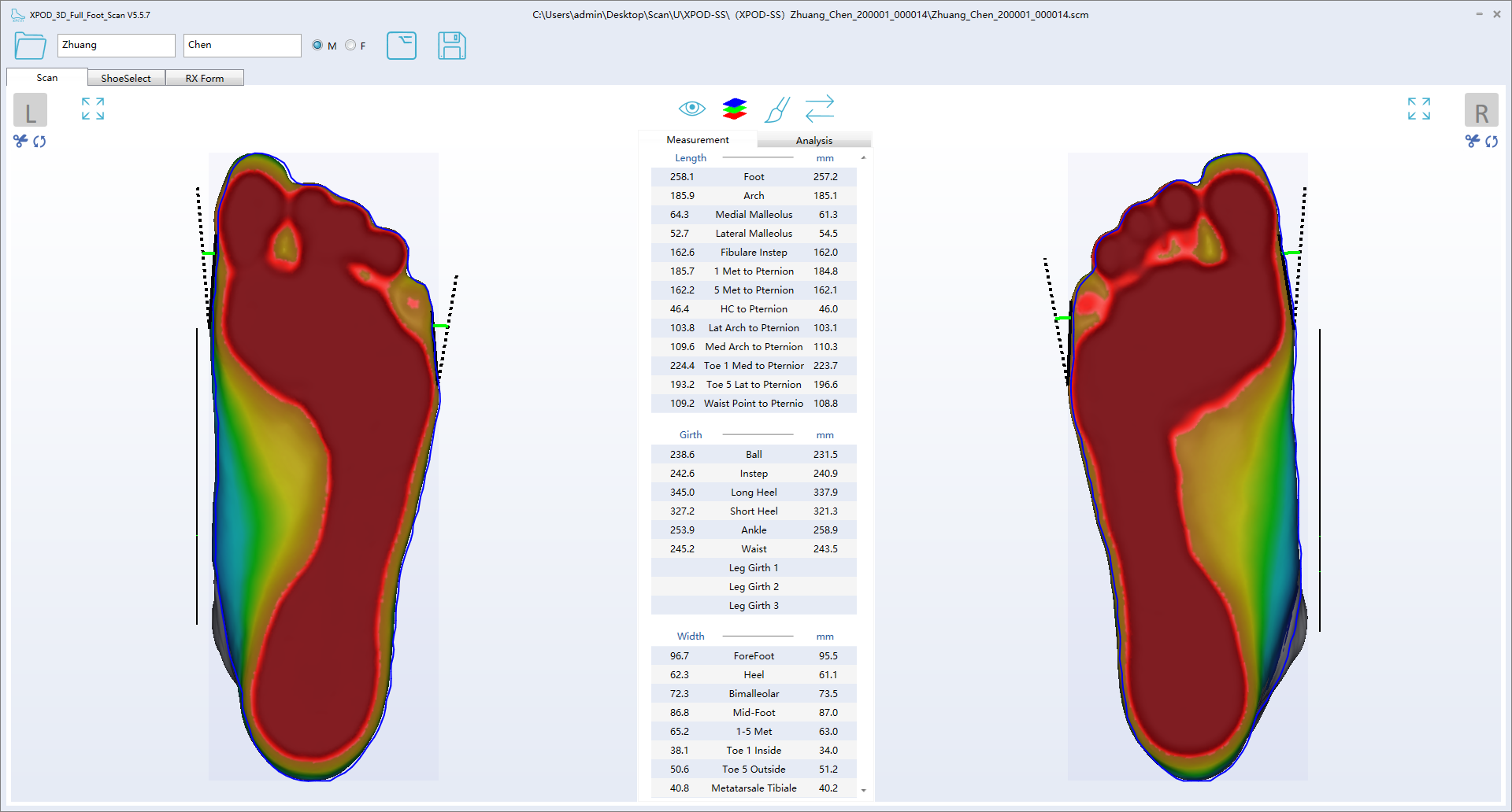 Precision Dynamic Foot Printer 维码科技 | Vismach 3D Laser Foot Scanner | Orthotic Insole CAD & CAM ...